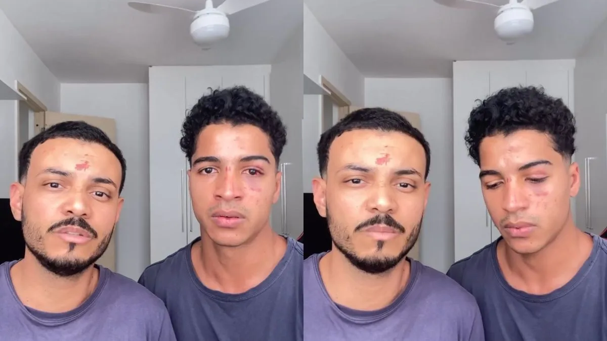 Casal denuncia ataque homofóbico após festa na UFRJ