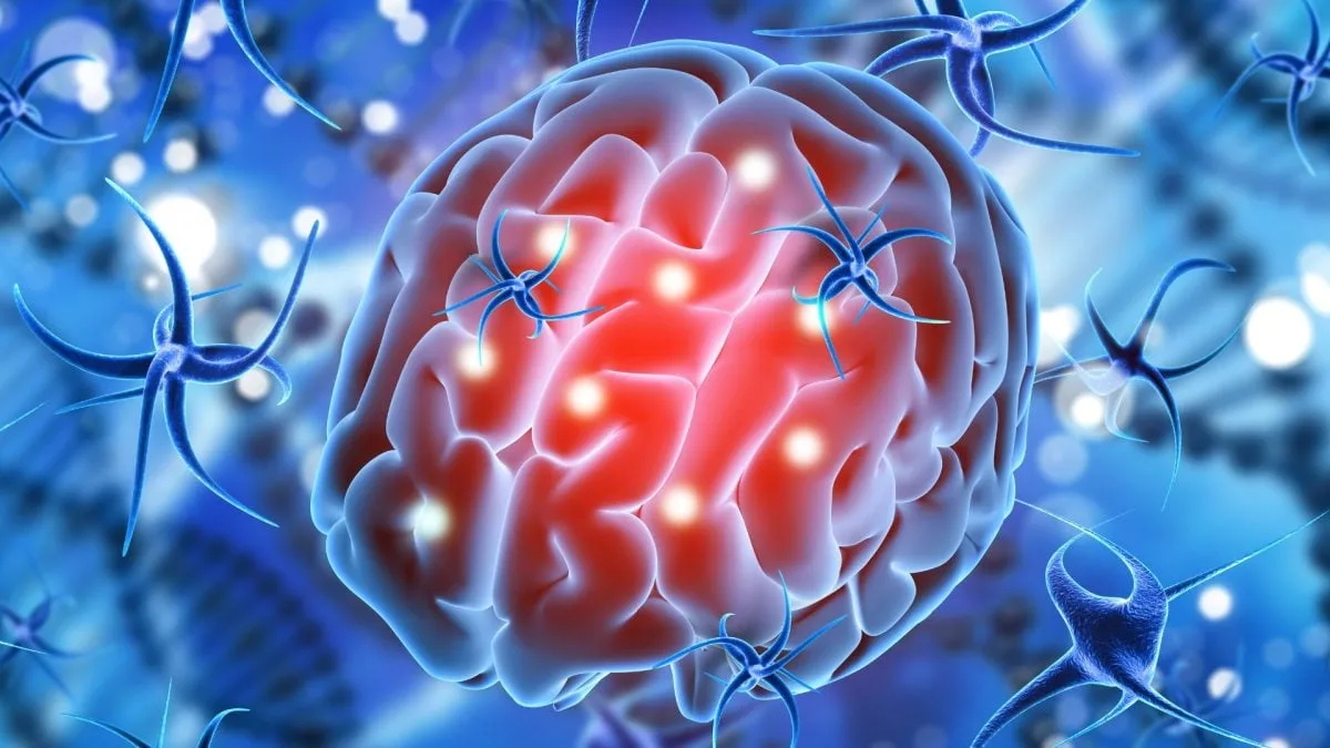 Silêncio neural prevê crise epiléptica