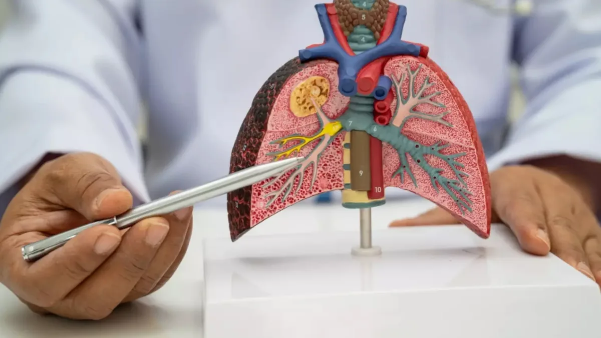 Estudo descobre marcadores para imunoterapia no pulmão